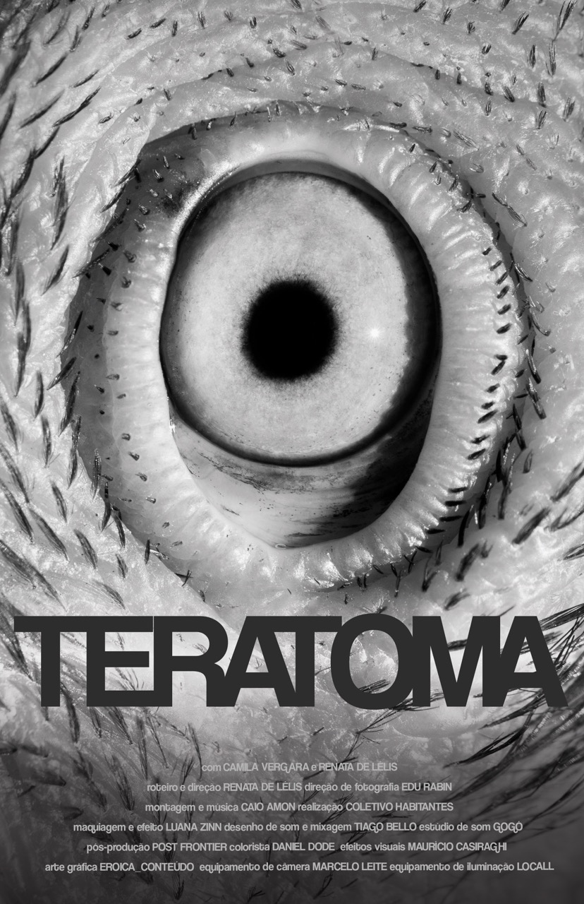 TERATOMA — imagem 5