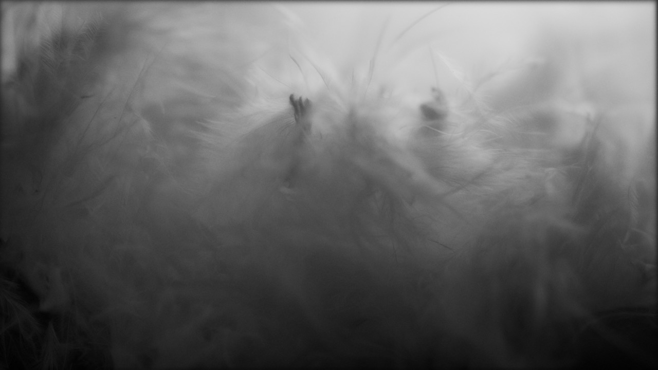 TERATOMA — imagem 9